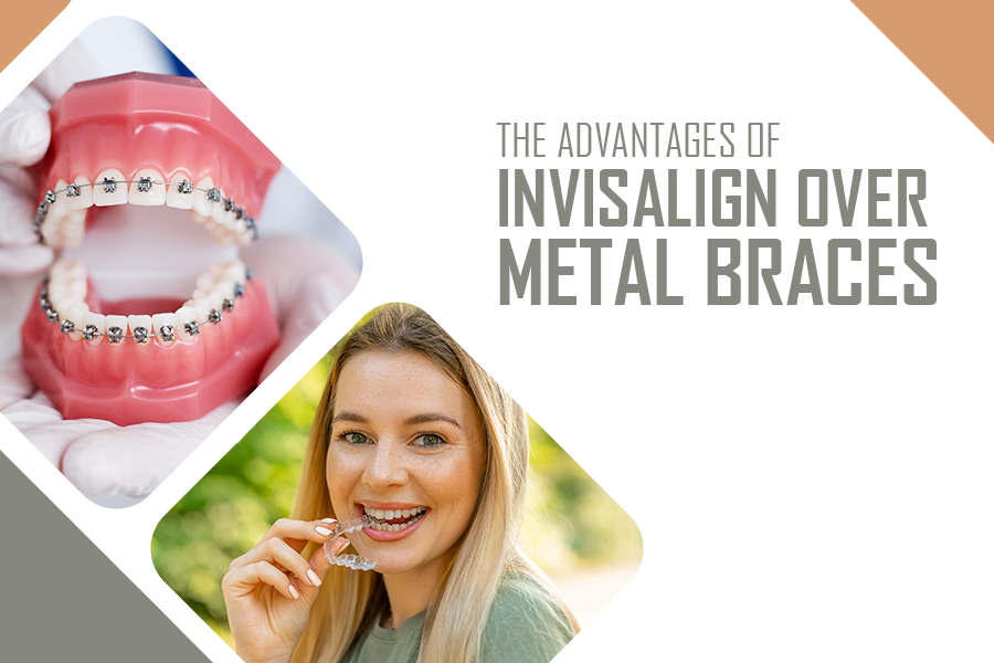 The Advantages of Invisalign over Metal Braces