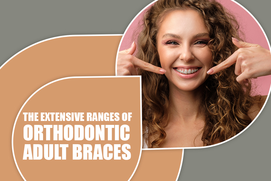 The Extensive Ranges of Orthodontic Adult Braces
